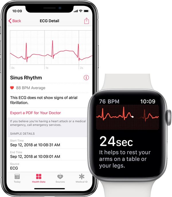 watchOS更新新苹果手表更新：体验心电图功能
